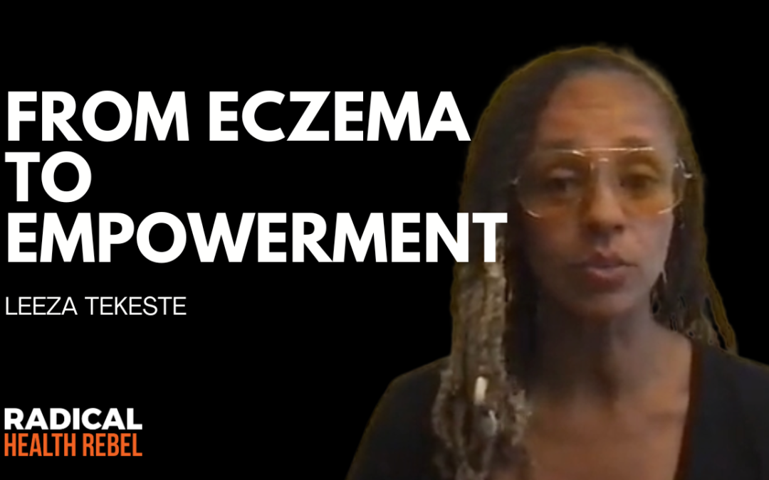 From Eczema to Empowerment: Leeza’s Holistic Journey with Leeza Tekeste